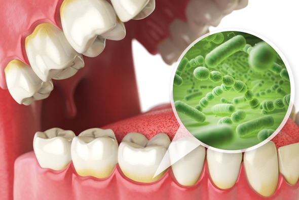 Dental illustration showing teeth and gums with magnified bacteria view, oral hygiene concept.