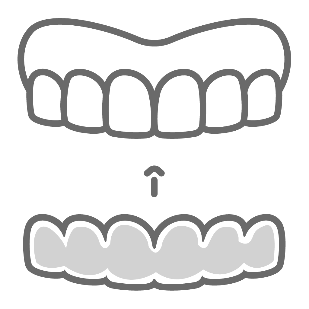 Upper and lower dental prosthetics or dentures aligned with arrow indicating bite relationship.